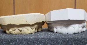A white and beige model of teeth on the floor